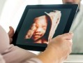 胎儿三级超声检查是什么,合项胎儿系统超声检查什么