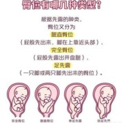 胎儿一直臀位什么原因,胎儿臀位原因造成的