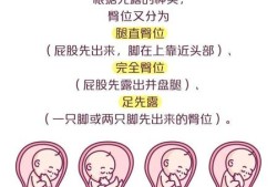 胎儿一直臀位什么原因,胎儿臀位原因造成的
