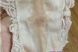 孕期白带乳白色正常吗（怀孕流白色液体正常吗？需要怎么做帮助自己）