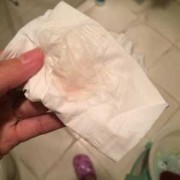 孕期保胎（怀孕身上出了好多血，保胎对胎儿健康有影响吗）