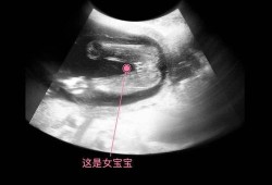 彩超怎么看胎儿大小（彩超怎么看胎儿大小）