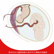 胎儿输血综合征（胎儿输血综合征）