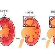 胎儿肾脏（胎儿肾脏发育时间）