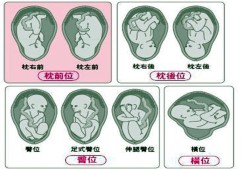 胎儿头位是左枕前位是什么意思呢,胎儿枕位置示意图