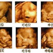胎儿相貌（胎儿相貌几个月形成）