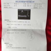孕38周肚子痛没有见红,38周胎儿发育好了吗正常吗