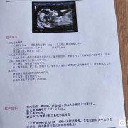 孕期检查都检查什么（孕妇做nt检查多少钱，NT检查是检查什么的）