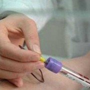 孕期抽血检查（孕妇做抽血的孕检，能够检查出有没有得了艾滋病吗）