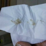孕期有褐色分泌物怎么回事,孕期分泌物多发黄正常吗