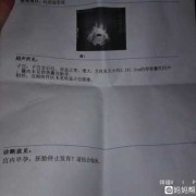 胎儿期停胎（怀孕有胎心胎芽还会引起停胎吗）