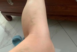 孕期腿酸（孕期腿酸）
