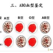 测胎儿血型有几种方法（孕期产检会对血型进行检查吗?一直都不知道自己是什么血型的，或者我可以自己处理呀）