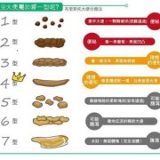 孕期大便变粗（孕妇大便很粗是什么原因）