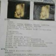 孕期征兆（孕期征兆99%暗示生女孩）