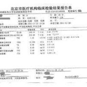 怀孕8个月甲功高对胎儿有什么影响,孕妇甲状腺高对胎儿的影响大吗