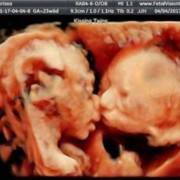 32周胎儿在肚子里图片（32周胎儿在肚子里的图片）