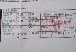 胎儿畸形的概率是多少,孕期畸形排查有哪些