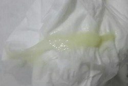 孕期流黄绿色分泌物（孕期流黄绿色分泌物对胎儿有影响吗）