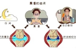 孕期关节响（身体关节响怎么回事）