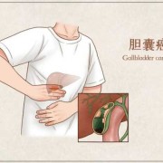 23周胎儿胆囊偏大（23周胎儿胆囊偏大有什么影响）