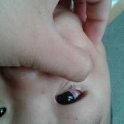 胎儿一只眼（一岁孩子眼睛红是怎么回事）