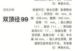 胎儿七斤多可以顺产吗（顺产的最佳双顶径）