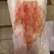 备孕期月经来了一小点（第一天月经只有一点点是怀孕了吗？我没其他感觉，怎样检查好啊）