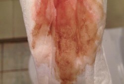 备孕期月经来了一小点（第一天月经只有一点点是怀孕了吗？我没其他感觉，怎样检查好啊）
