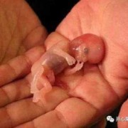 8周多适合做人流吗？人流的最佳时间是怀孕多长时间,八周胎儿人流下来图