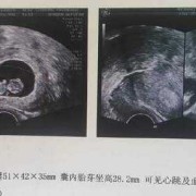 怀孕39天胎儿的发育图（39天的宝宝能看多远）