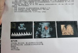 胎儿右肾双肾盂（27周的胎儿产检发现只有一个肾可以生吗）