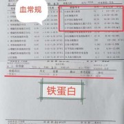 血常规贫血看哪个指标,血常规最怕三种指标低