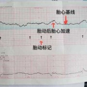 做胎心监护对胎儿有影响吗（天天做胎心监护对胎儿有影响吗）
