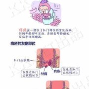 孕期长痔疮了怎么办,孕期痔疮怎么办,有个肉球