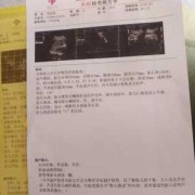 胎儿脖子上有U型压痕（胎儿脖子上有U型压痕）