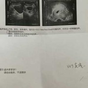 怀孕多少周有胎心,50天没胎心还有希望吗