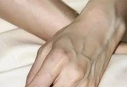 孕期有青筋（孕期青筋暴起是什么原因）