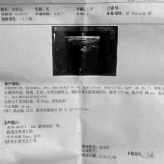 孕期检查报告（孕期检查报告医院要收回留档吗）