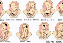 胎位RSA是什么意思，我不明白,胎儿骶前位是什么意思