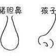 胎儿鼻低平（狮子鼻和猪鼻子区别）