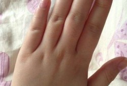 怀孕期间手指关节疼痛（怀孕期间手指关节疼痛）