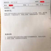 脑核磁共振能查出什么疾病,胎儿核磁共振能检查什么,多少钱
