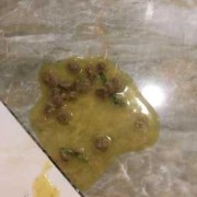 怀孕吐黄水要治疗吗,孕期呕吐黄水发苦是什么原因