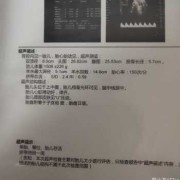 胎儿腿短是怎么回事？怎么补救啊,胎儿发育腿短什么原因