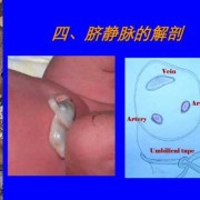 胎儿脐带内血管有（脐带是什么样的）