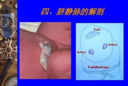胎儿脐带内血管有（脐带是什么样的）