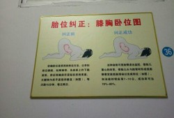 胎儿趴（孕妇趴着调整胎位该怎么做好）