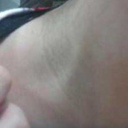 孕期脖子长纹（脖子上一条条纹路是什么）