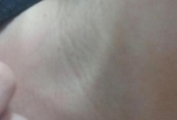 孕期脖子长纹（脖子上一条条纹路是什么）